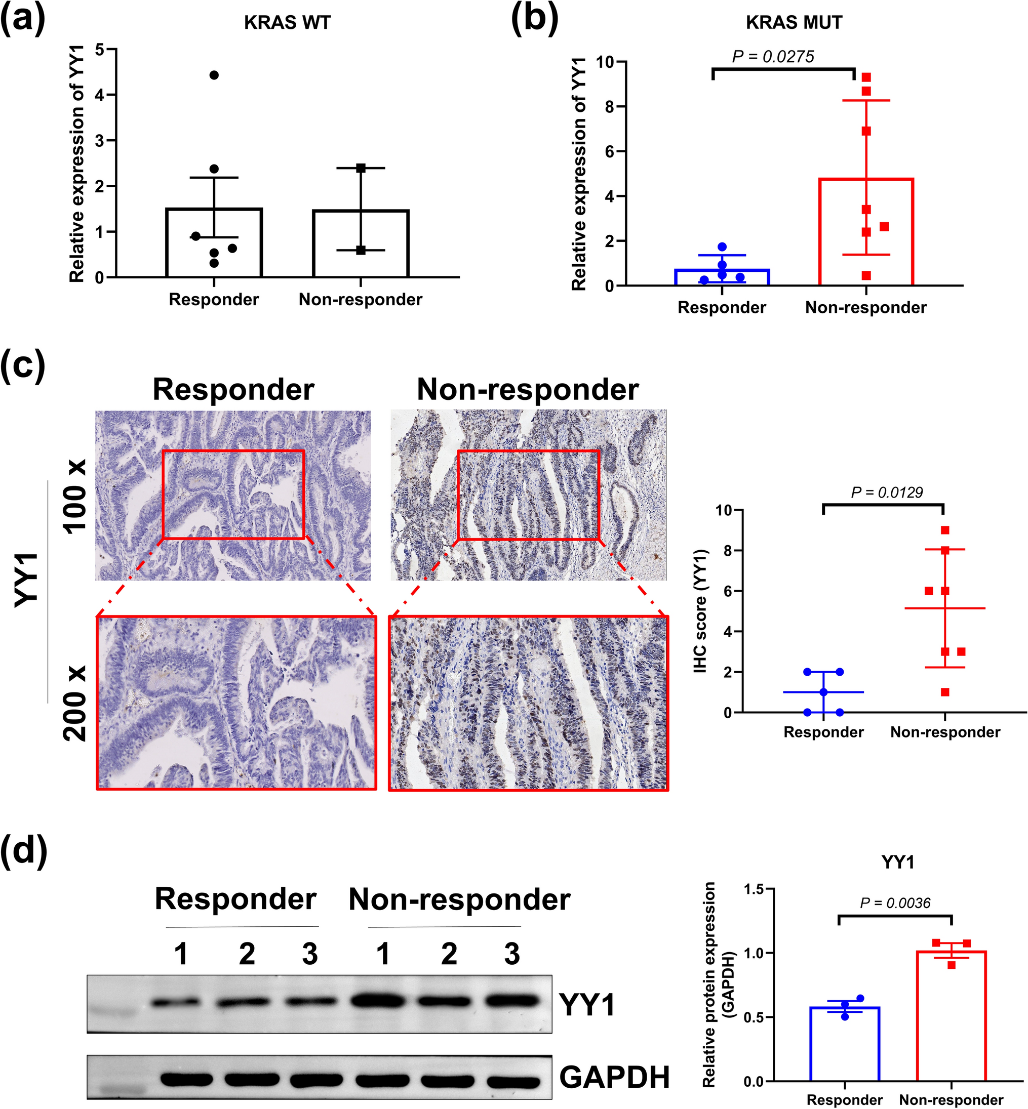 YY1 as a mediator to enhance the resistance of KRAS mutant colorectal cancer cells to cetuximab
