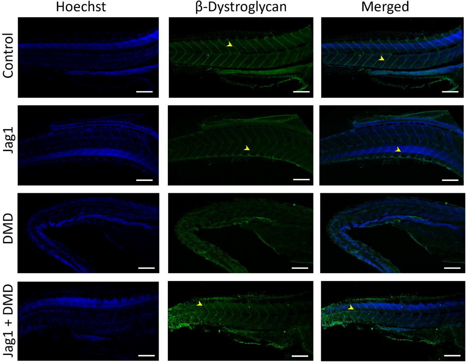 JAG1 overexpression partially rescues muscle function in a zebrafish model of duchenne muscular dystrophy