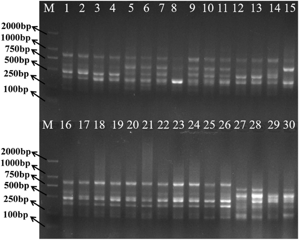 Development of specific molecular markers for medicinal peony () with double flower