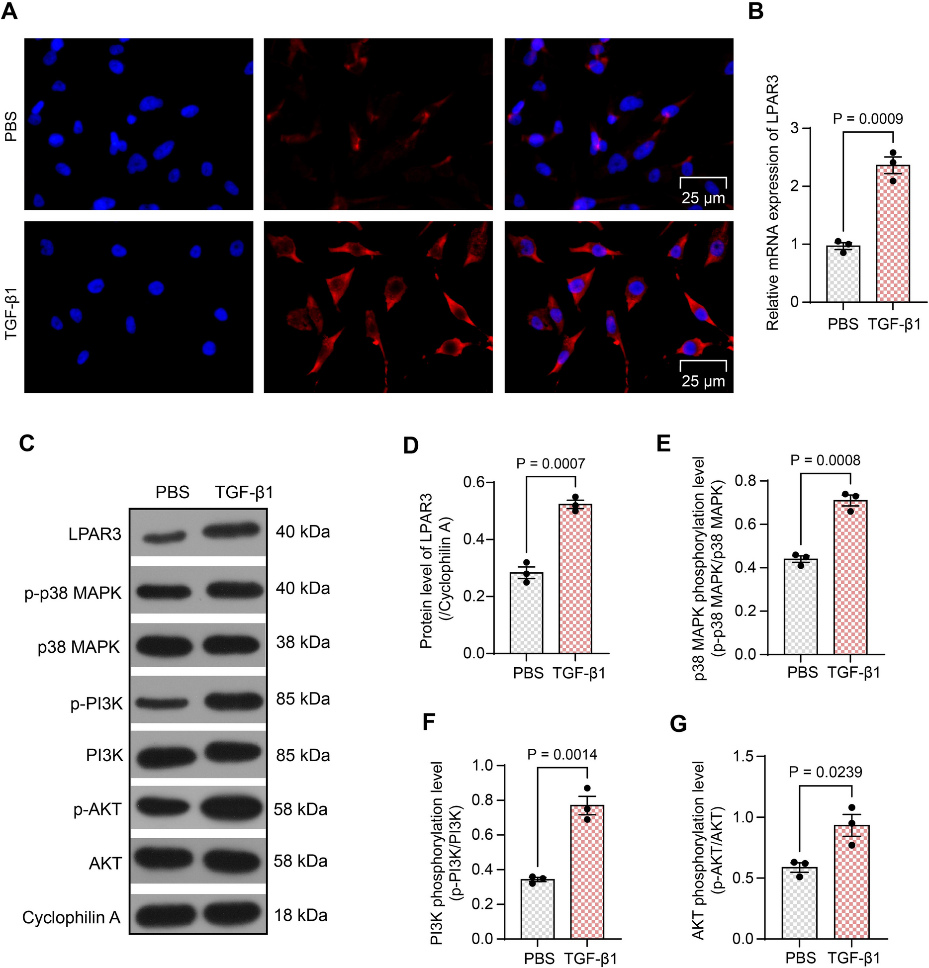 TEAD4-mediated upregulation of LPAR3 augments hepatic stellate cell activation in portal hypertension