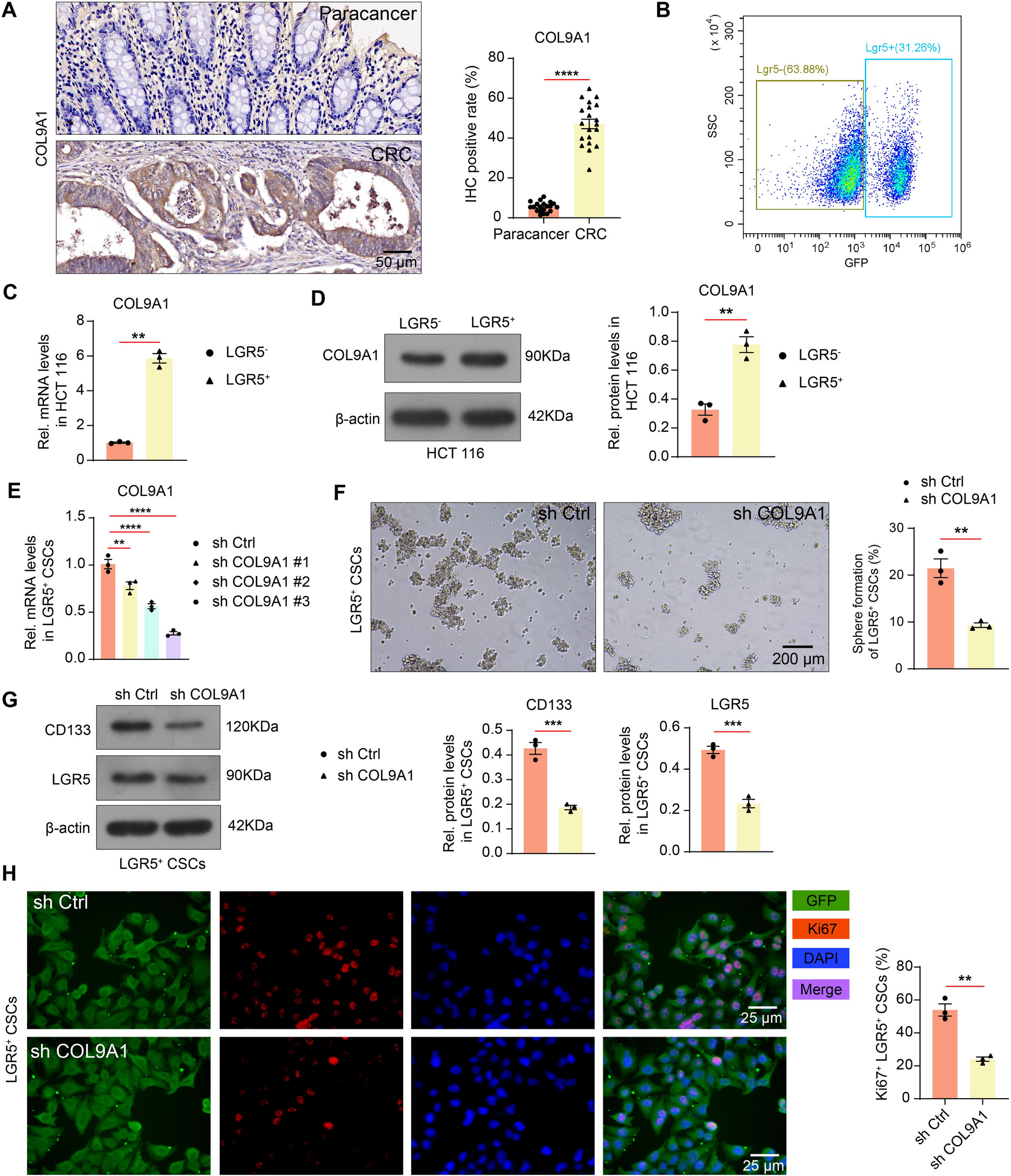 KMT2D/ZNF460-induced COL9A1-mediated extracellular matrix stiffness maintains the cancer stem cell pool to promote colorectal cancer progression