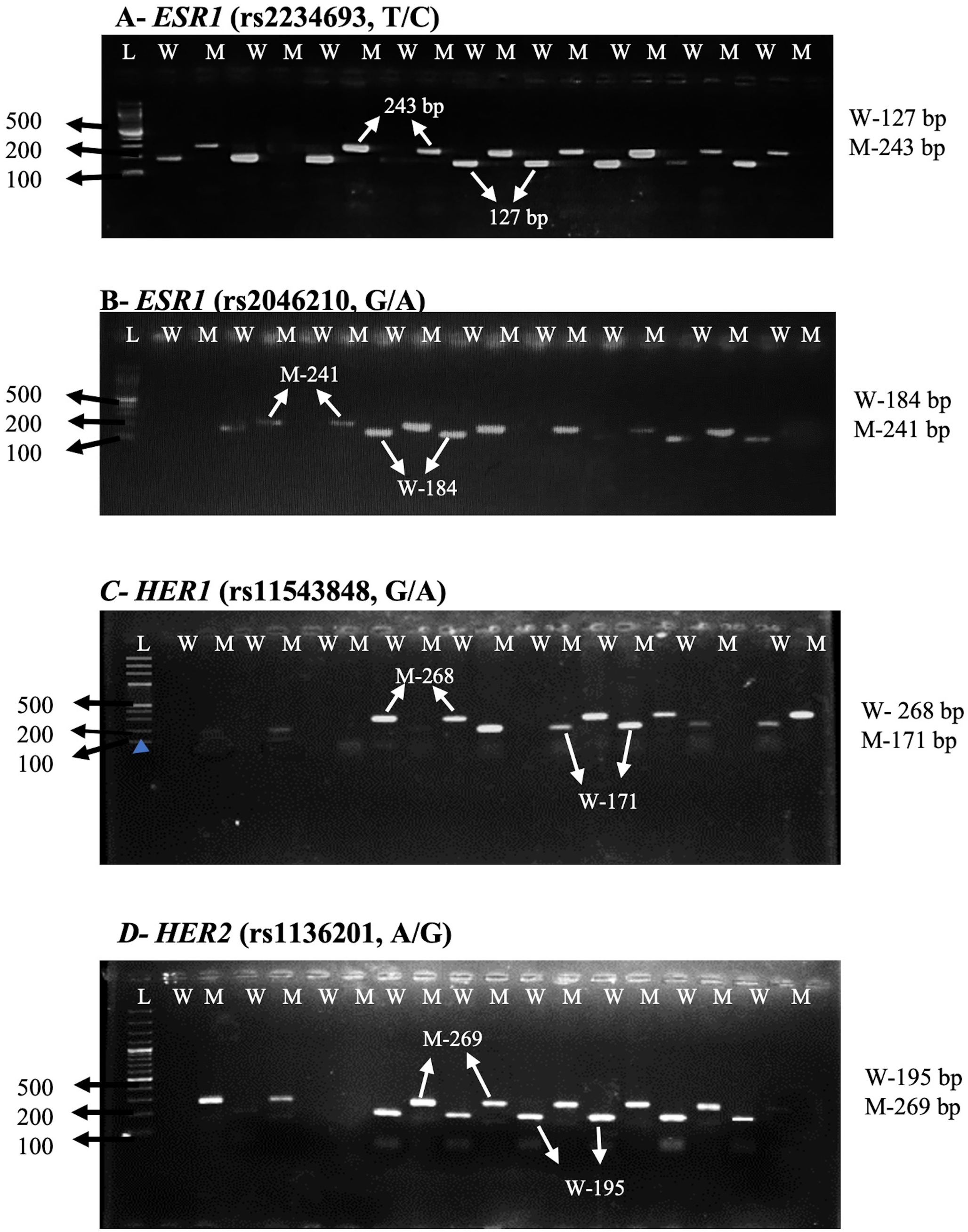 Association of , , and  Polymorphisms with Breast Cancer Risk in the KP Population, A Case-Control Study