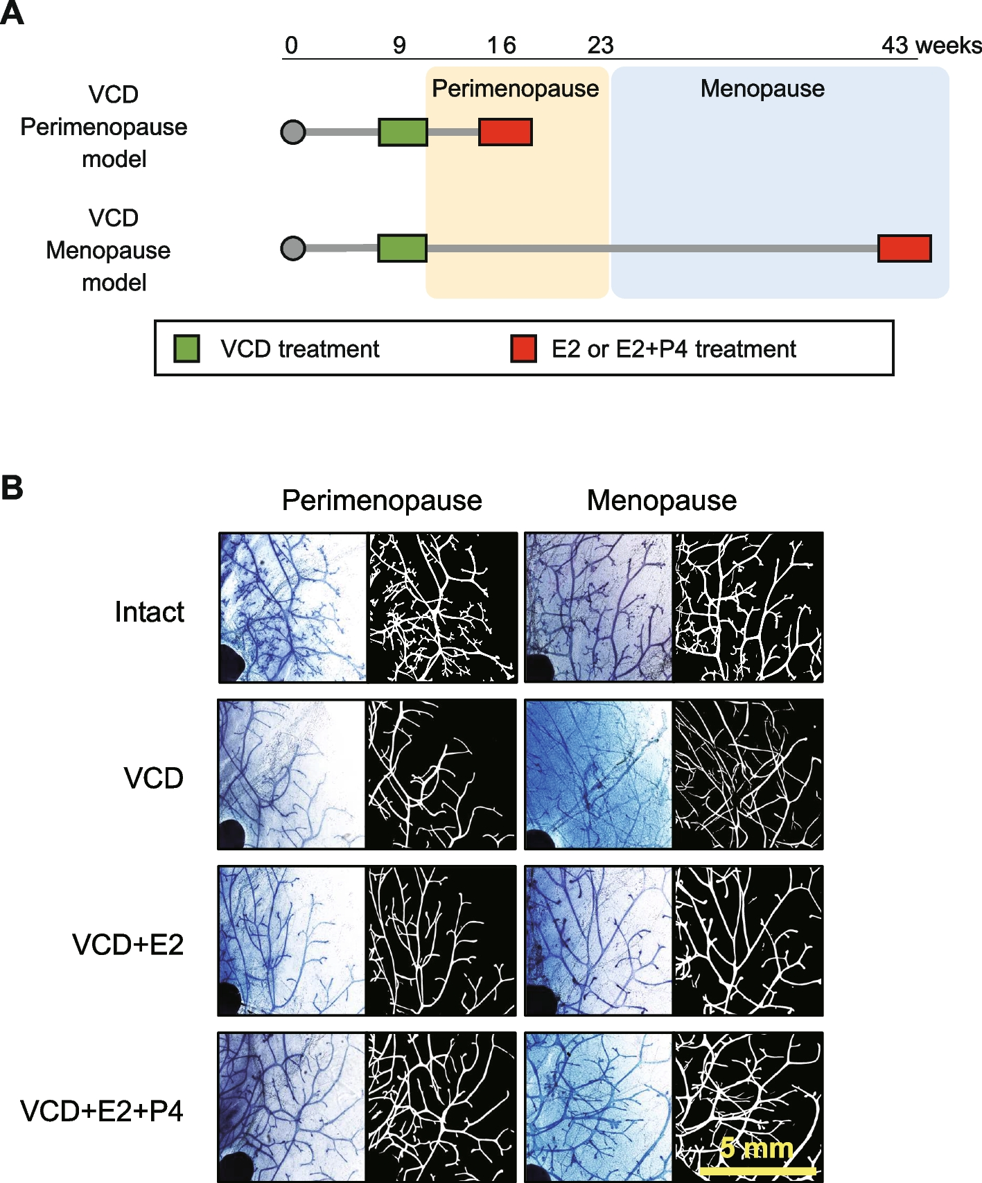 Perimenopausal and Menopausal Mammary Glands In A 4-Vinylcyclohexene Diepoxide Mouse Model
