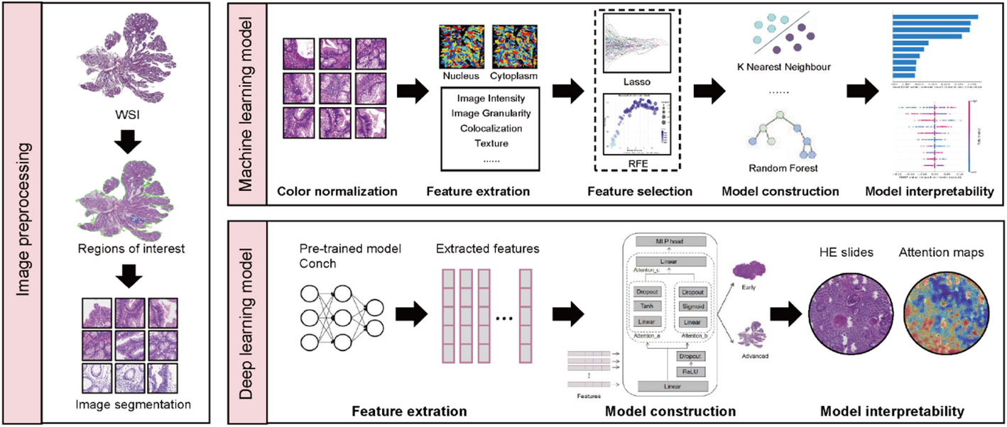 Pathological omics prediction of early and advanced colon cancer based on artificial intelligence model