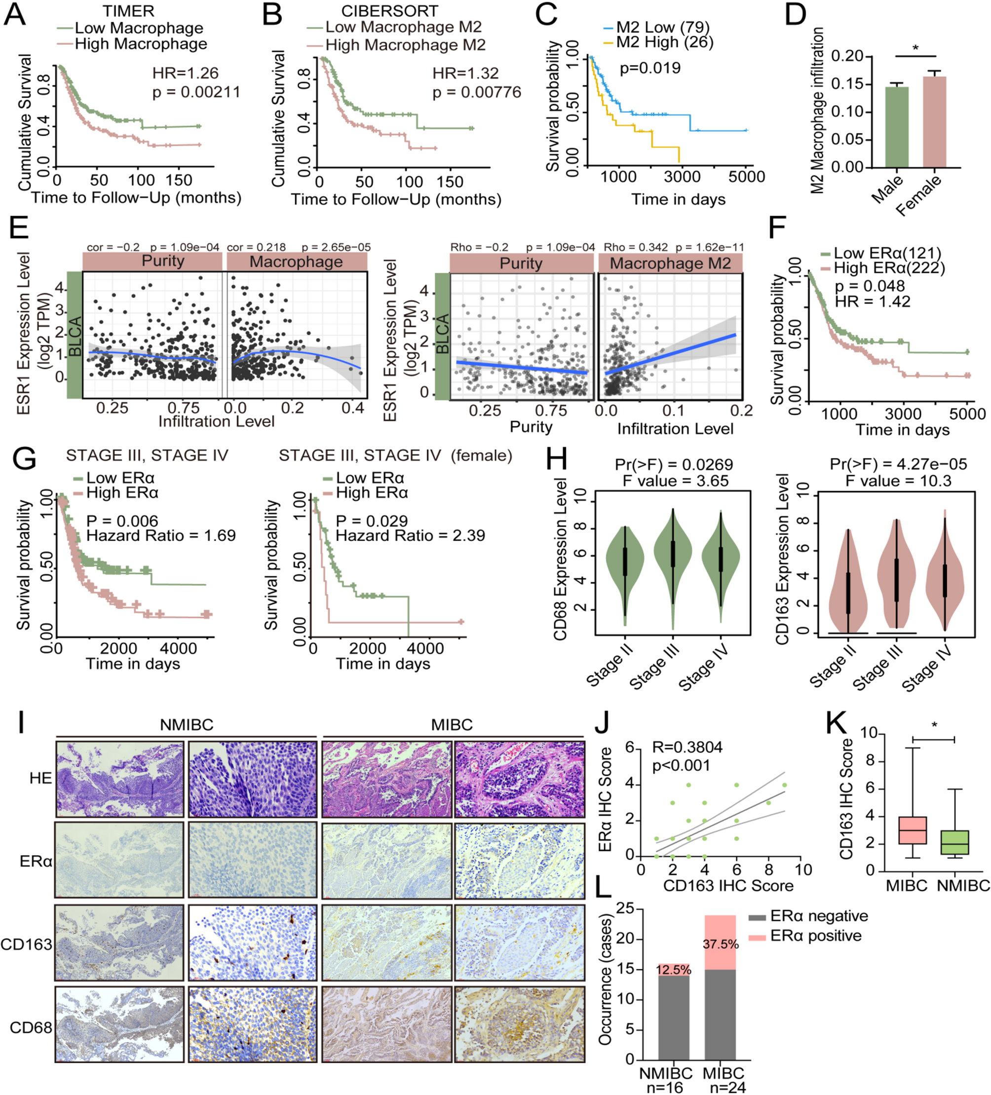 ERα-dependent crosstalk between macrophages and cancer cells potentiates vasculogenic mimicry and M2 macrophage polarization in bladder cancer