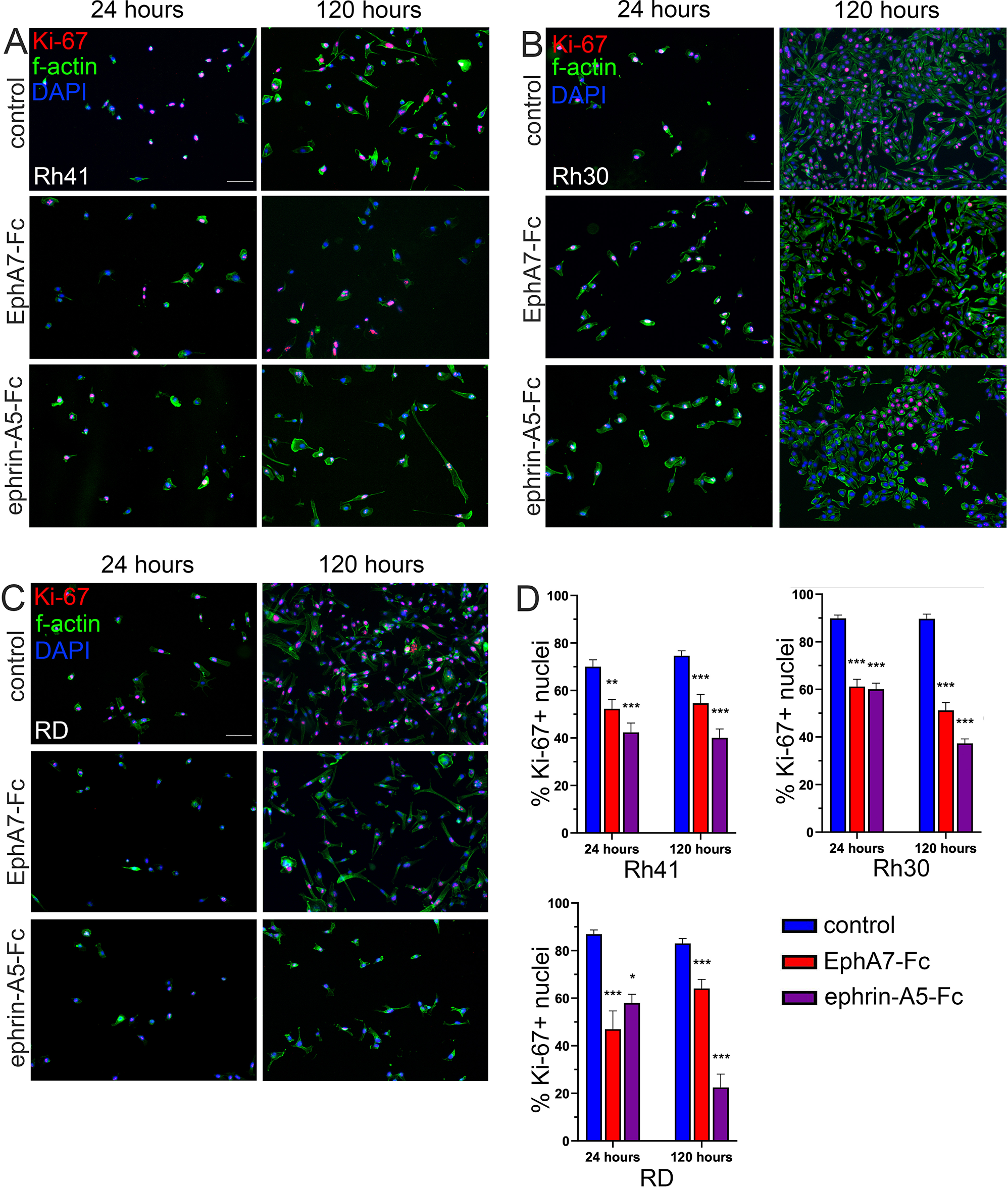 Ephrin-A5 or EphA7 stimulation is anti-proliferative for human rhabdomyosarcoma in vitro