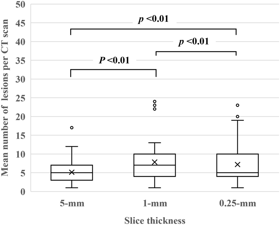 Performance of a deep-learning-based lung nodule detection system using 0.25-mm thick ultra-high-resolution CT images