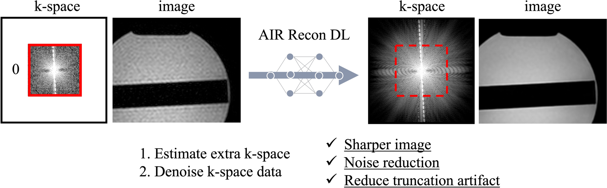 Usefulness of compressed sensing coronary magnetic resonance angiography with deep learning reconstruction