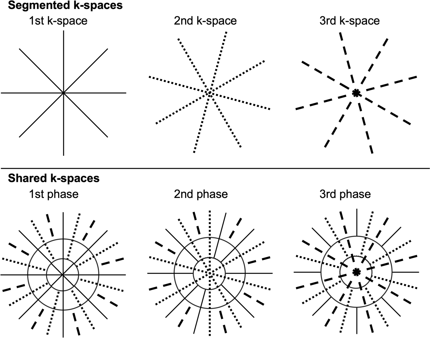 Ultrafast MRI and diffusion-weighted imaging: a review of morphological evaluation and image quality in breast MRI