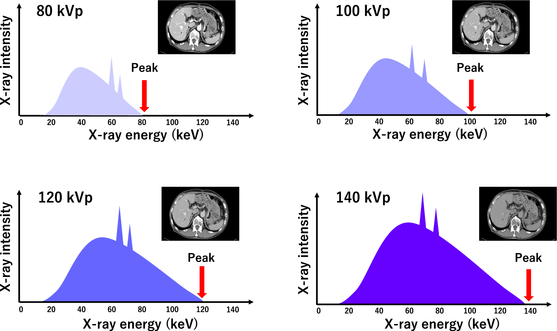 Contrast medium dose optimization in the era of multi-energy CT