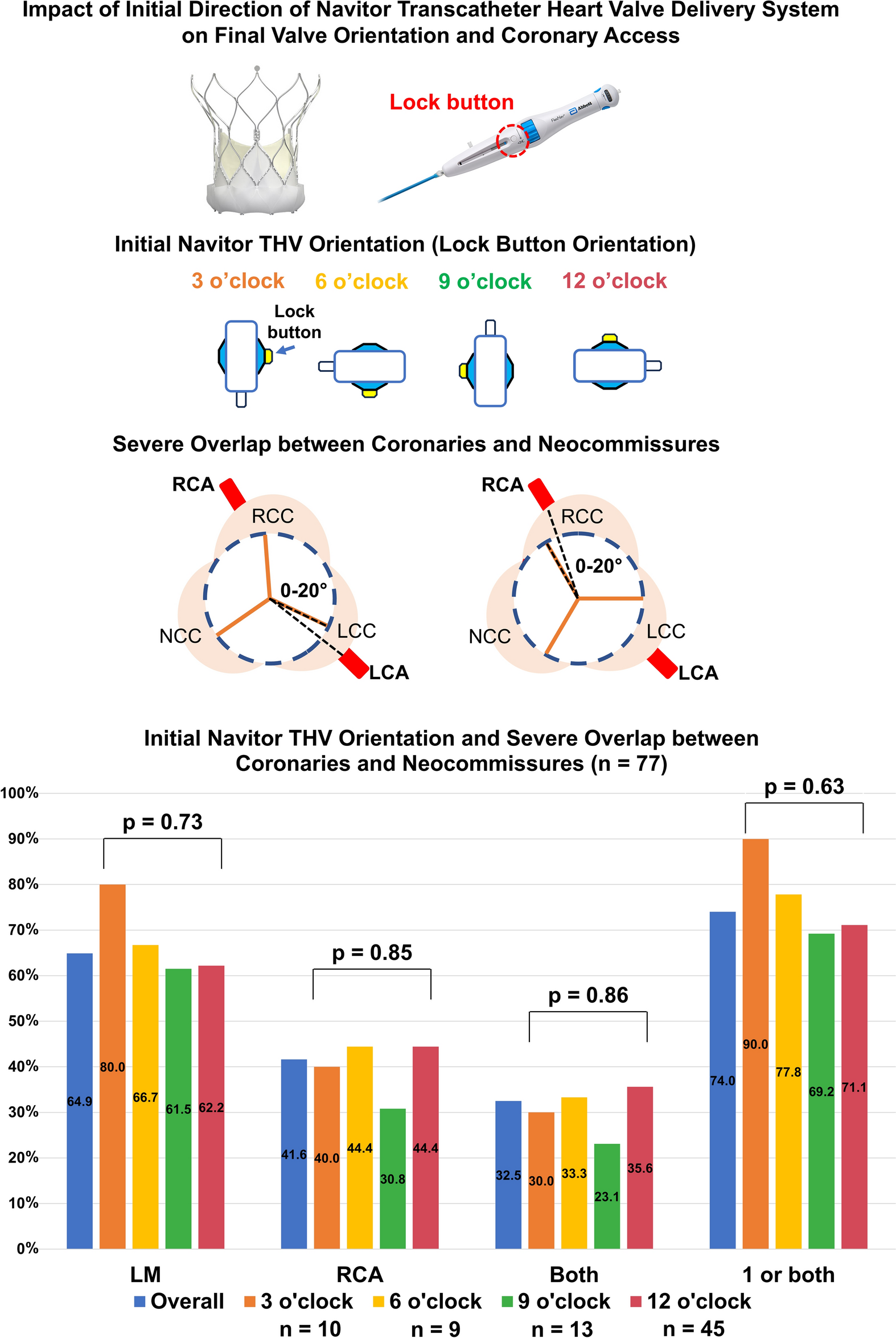 Impact of initial direction of Navitor transcatheter heart valve delivery system on final valve orientation and coronary access