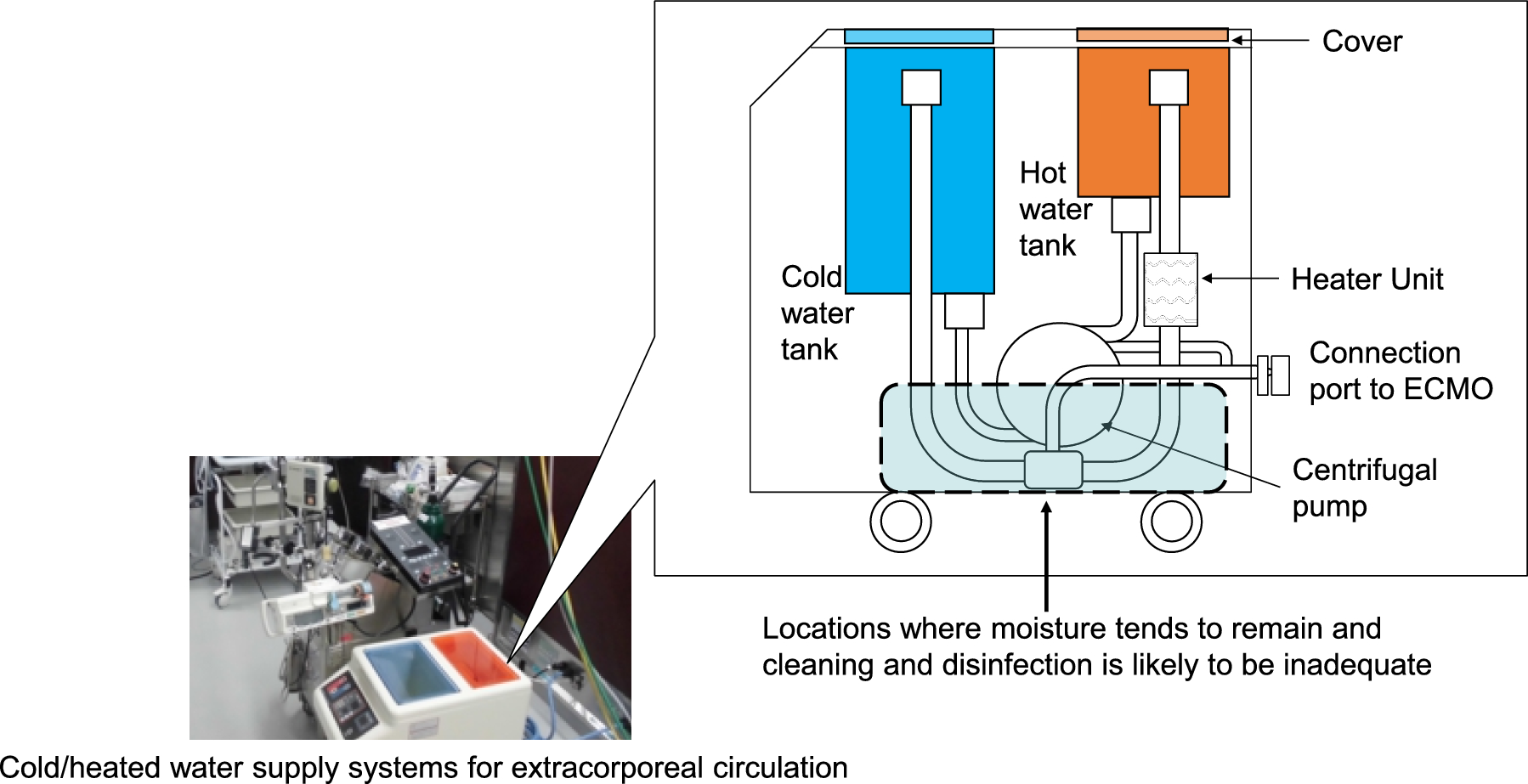 Investigation of contamination and environmental exposure of cold/heated water supply systems for extracorporeal circulation used in ECMO and other applications