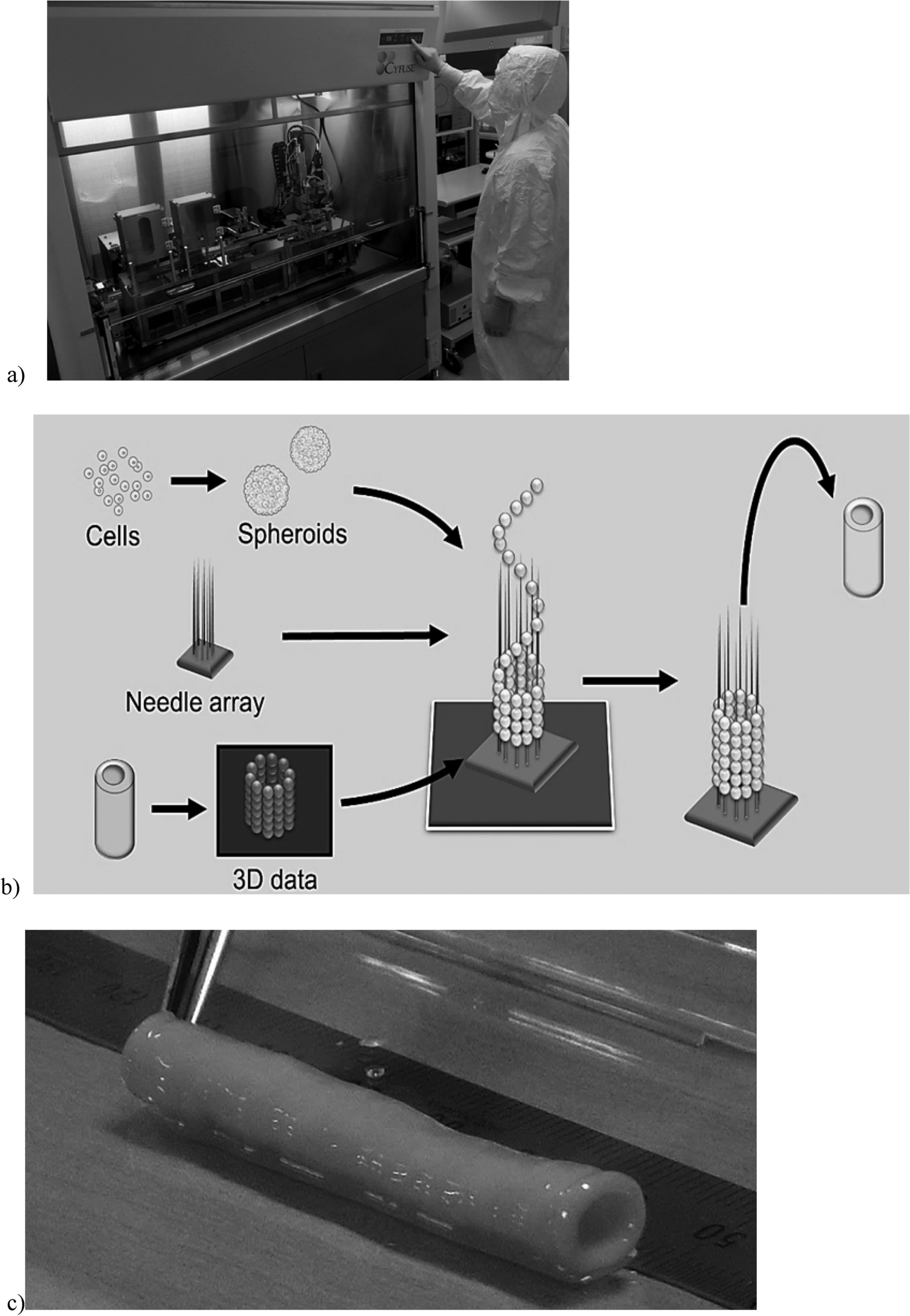Artificial blood vessels-clinical development of TEVG
