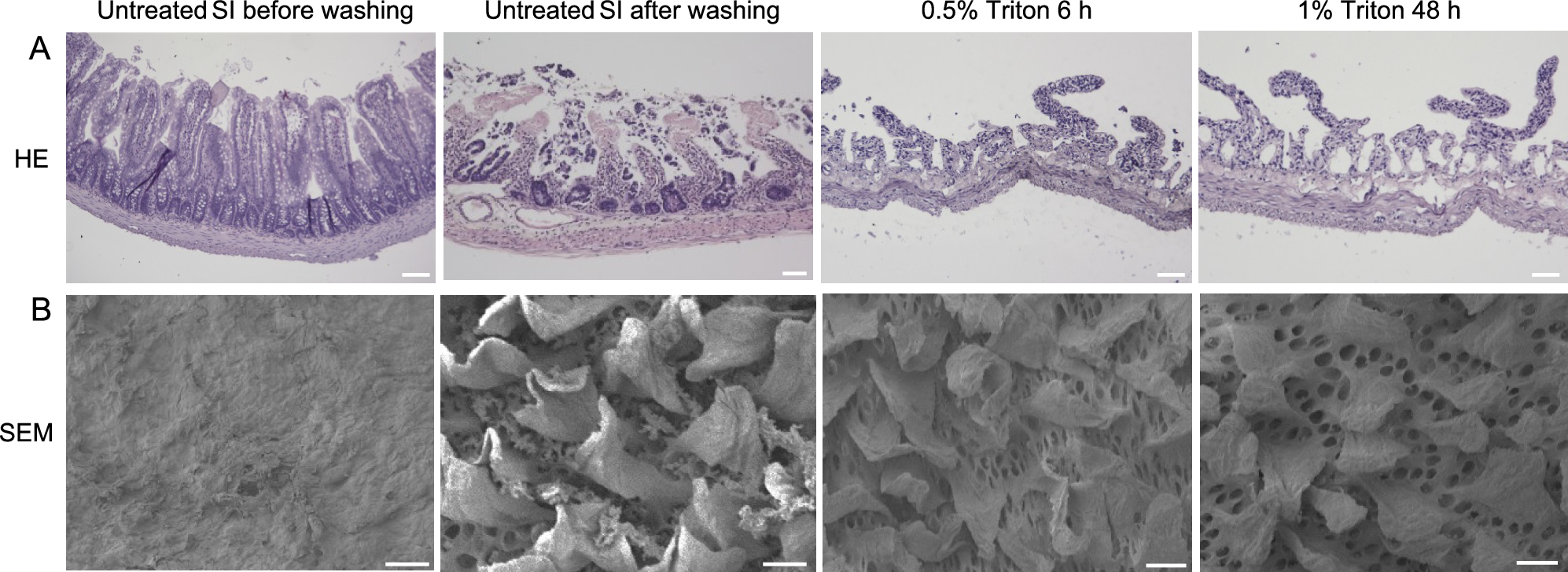 Effect of ECM nanostructures in decellularized small intestine on differentiation of intestinal epithelial model cells