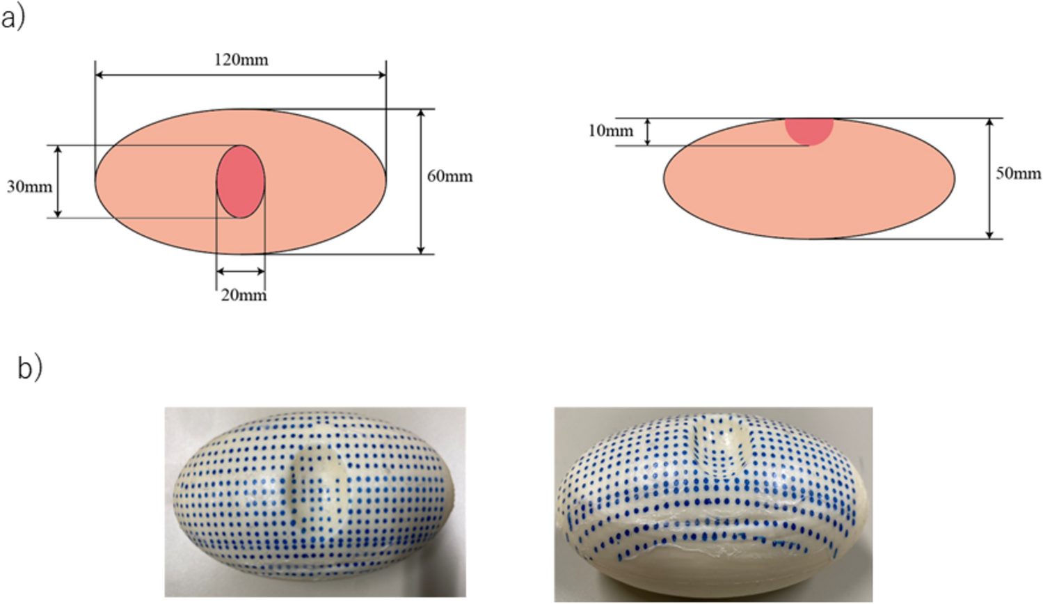 Visualization of parenchymal deformation during renorrhaphy: a novel deformation index in a simulated kidney model