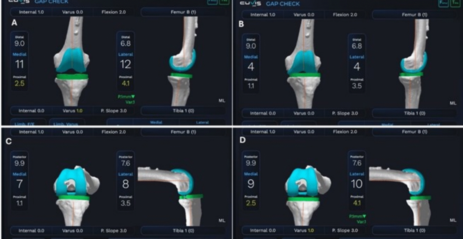 The role of next-generation robotic systems in transforming knee arthroplasty: precision and beyond