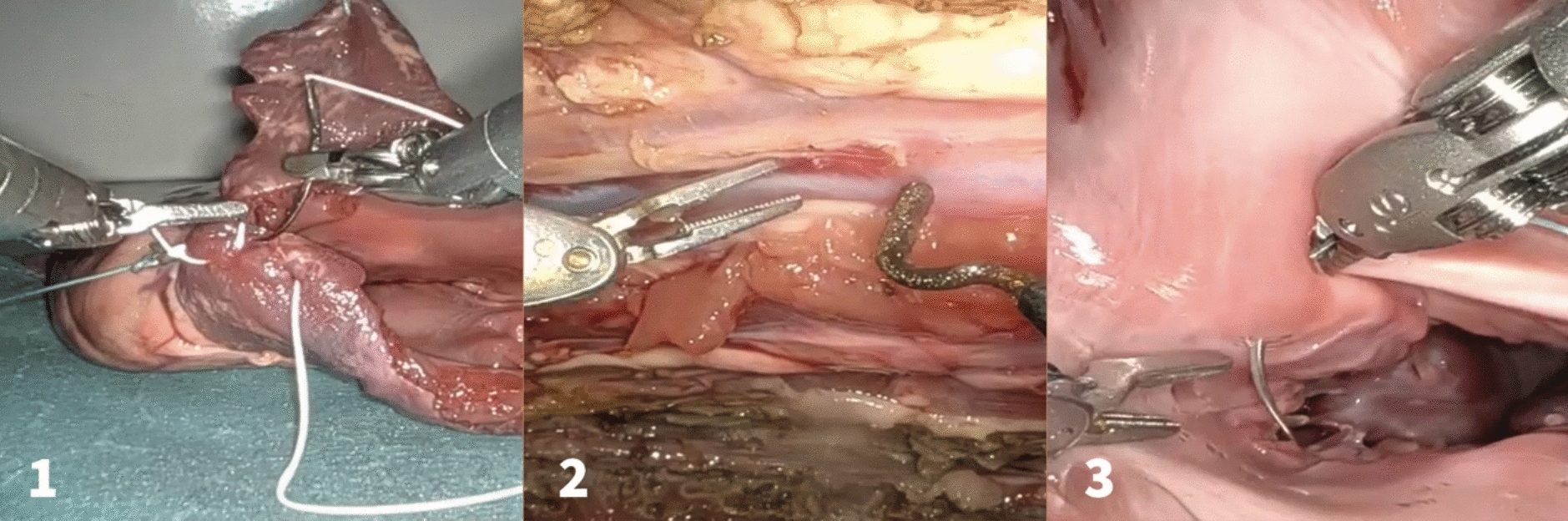 Artificial intelligence-based action recognition and skill assessment in robotic cardiac surgery simulation: a feasibility study