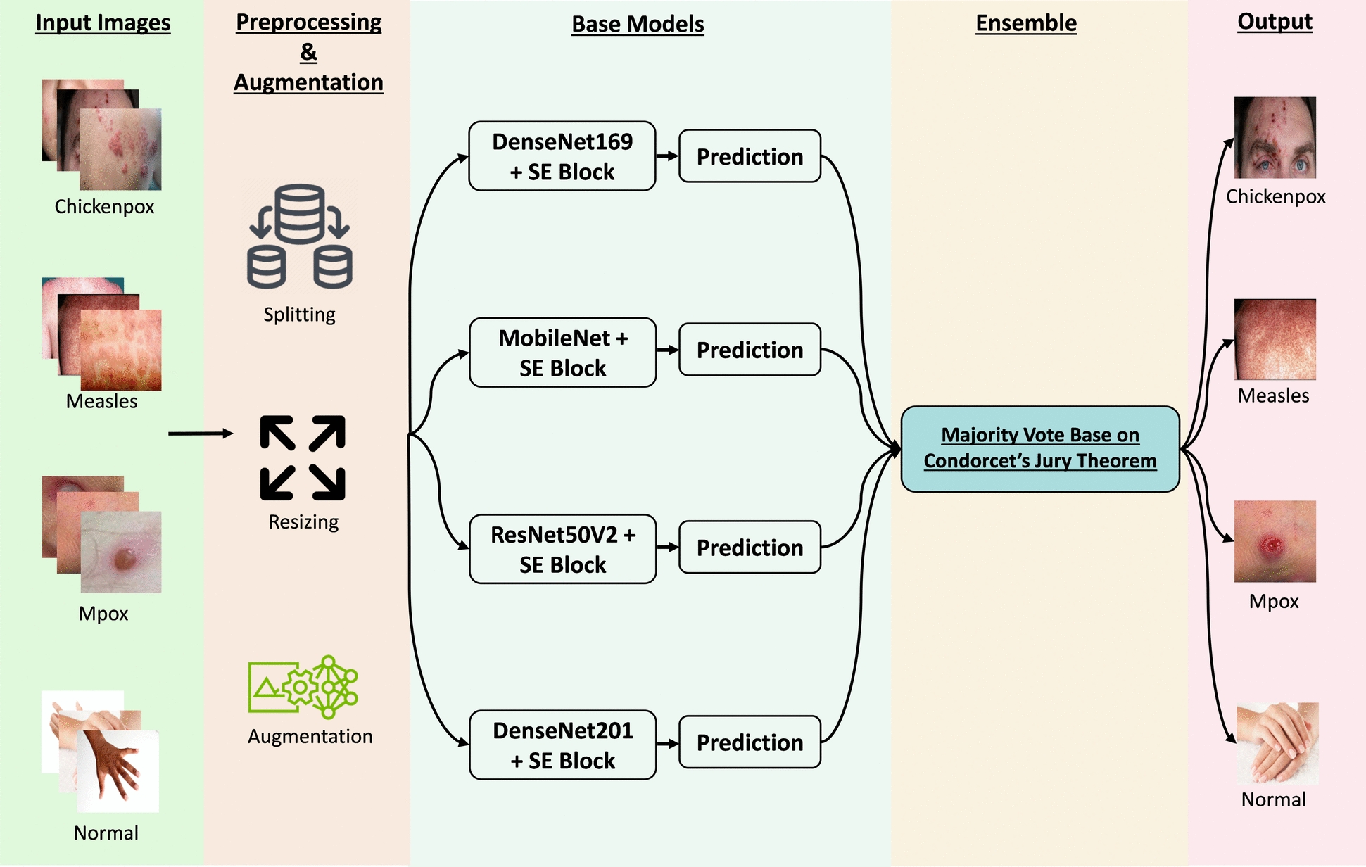JuryFusionNet: a Condorcet’s jury theorem-based CNN ensemble for enhanced monkeypox detection from skin lesion images