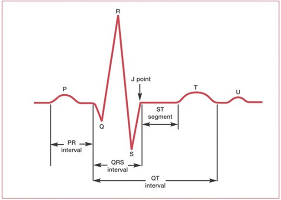 CnnBoost: a multilevel explainable stacked ensemble framework for effective detection of Myocardial Infarction from 12-lead ECG images using a transformational approach