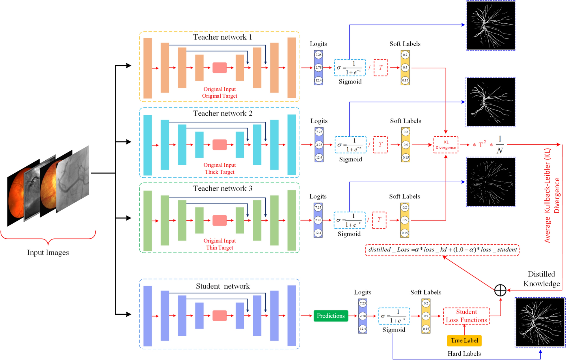 Multi-teacher based knowledge distillation for retinal vessel segmentation
