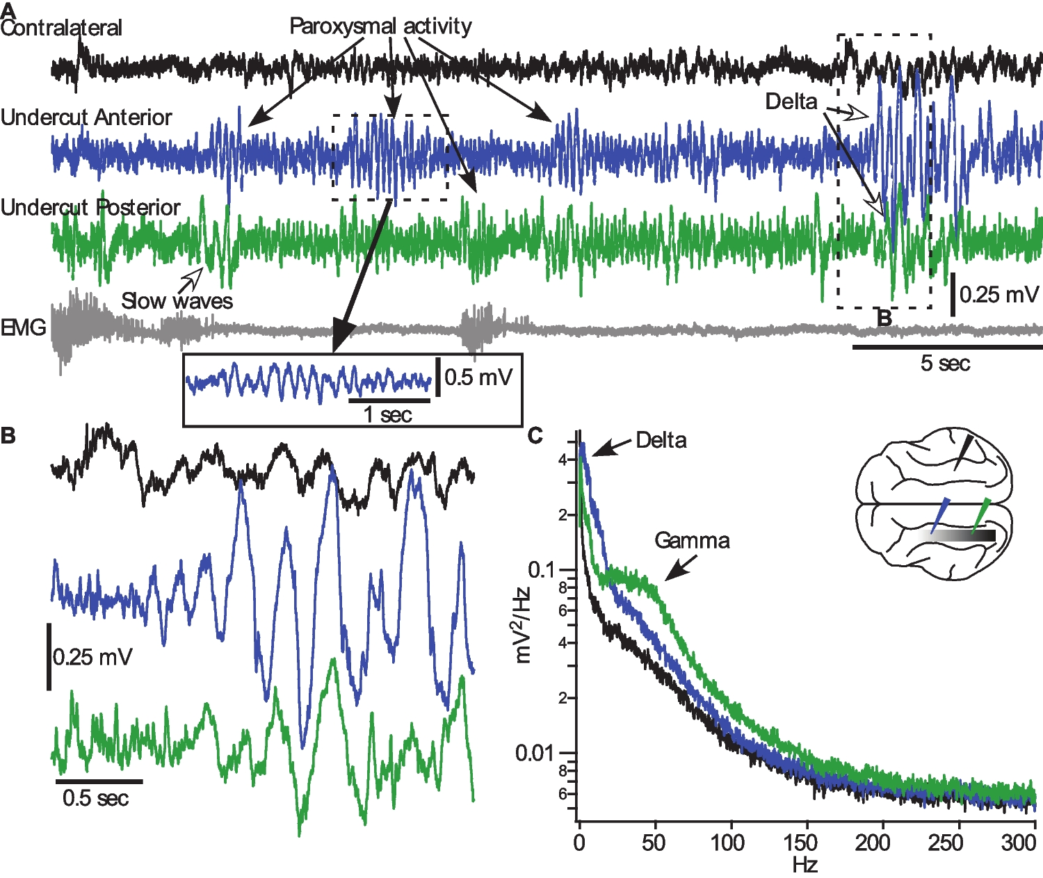 Network effects of traumatic brain injury: from infra slow to high frequency oscillations and seizures