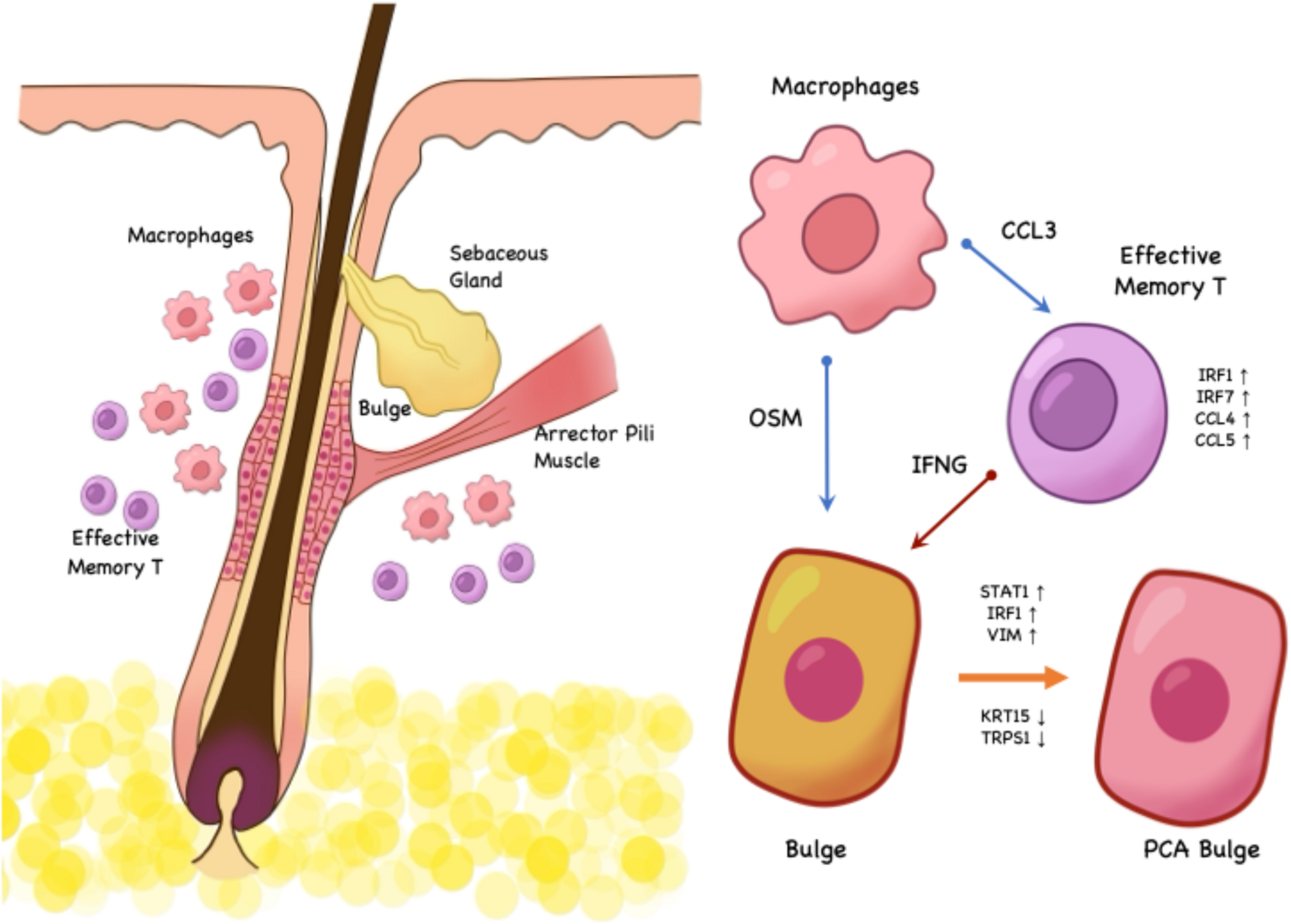Single-cell sequencing combined with spatial transcriptomics reveals the characteristics of follicle-targeted inflammation patterns in primary cicatricial alopecia