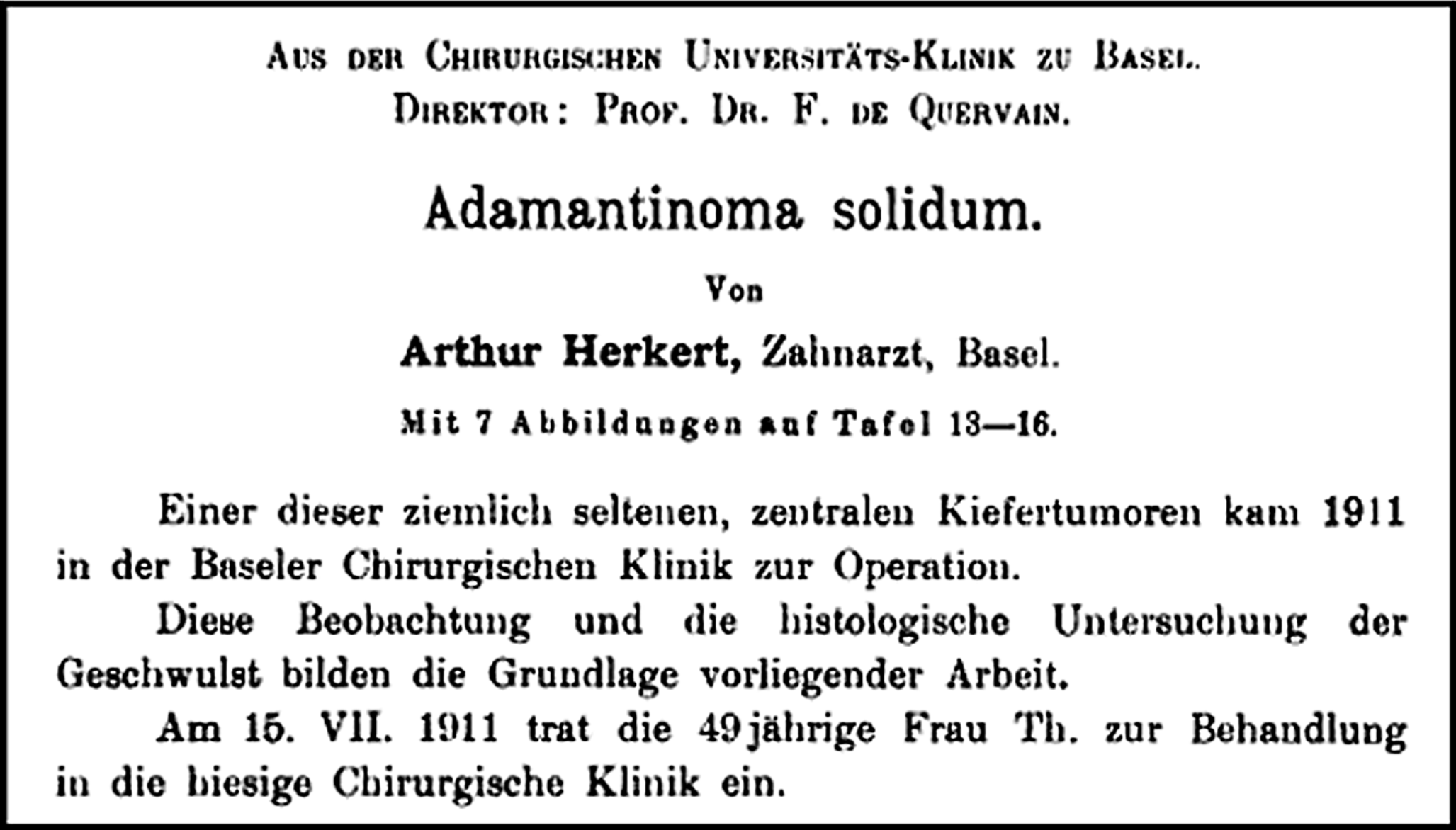 Revision of an Early History of Calcifying Epithelial Odontogenic Tumor: Herkert’s Original Description (1914)