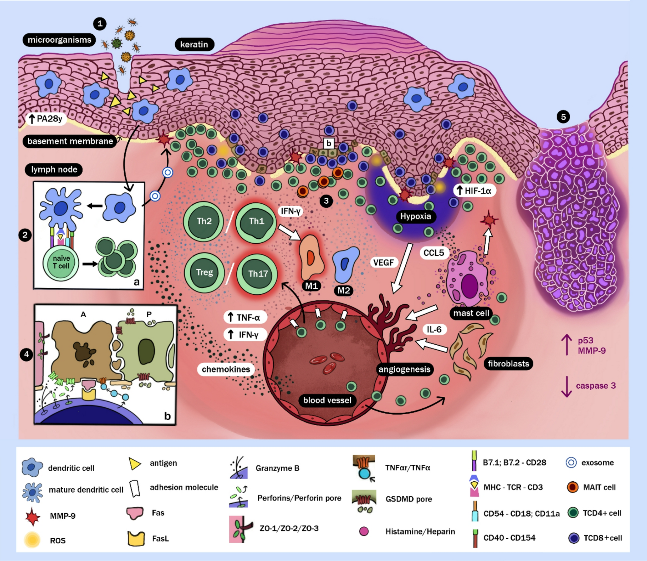 Etiopathogenesis of Oral Lichen Planus: A Review