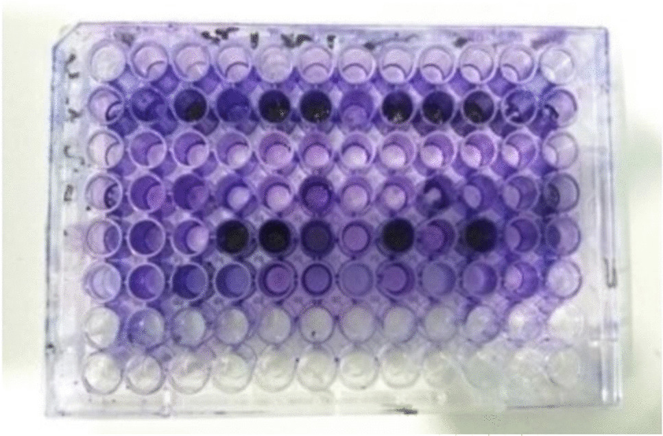 Phytochemical Composition and Bioactivities of  (Briq.) Leaf Extracts: Antimicrobial and Antibiofilm Properties