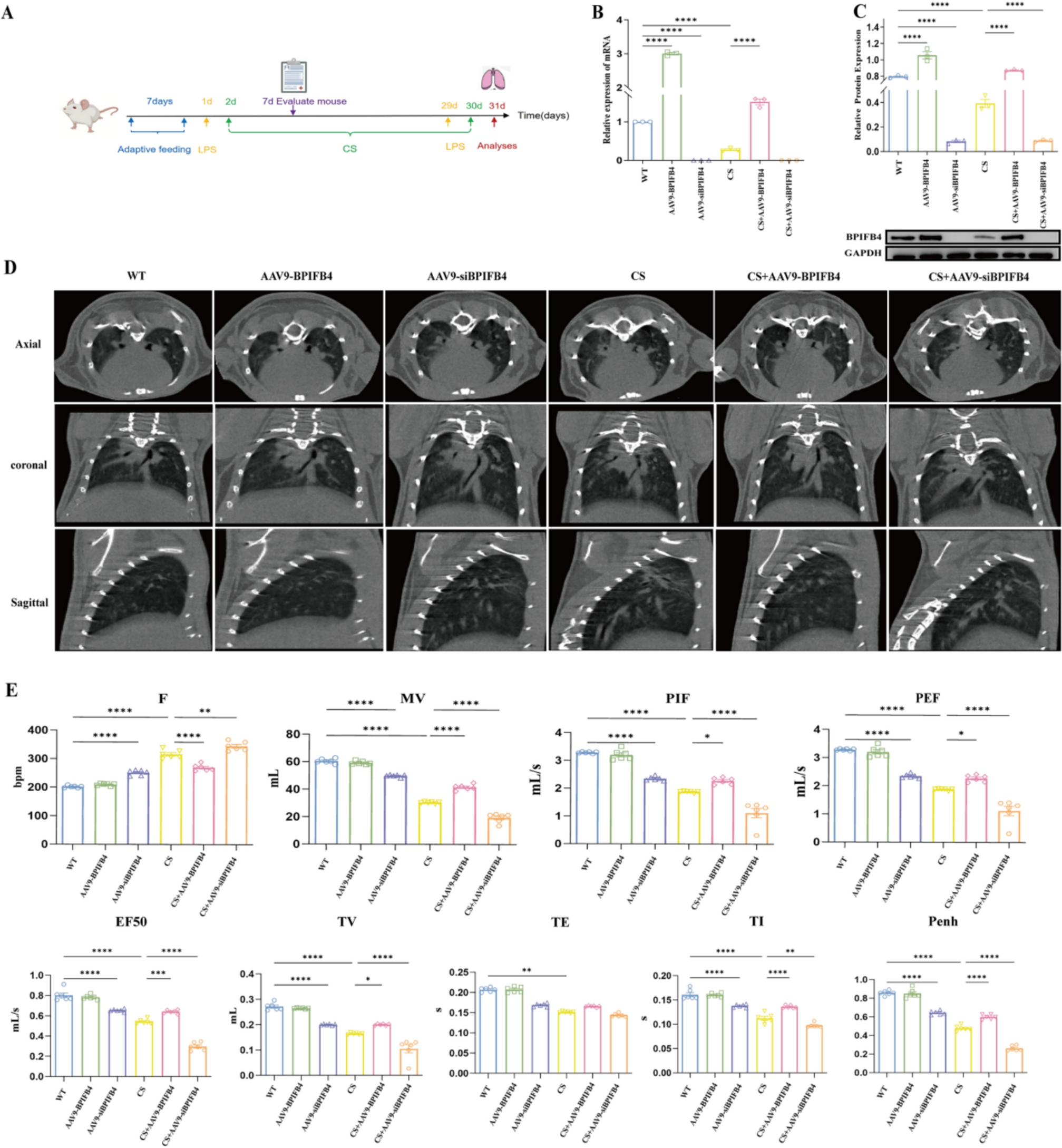 Overexpression of BPIFB4 Alleviates COPD Inflammatory Damage by Inhibiting M1 Macrophage Activation via the PI3K/AKT Pathway