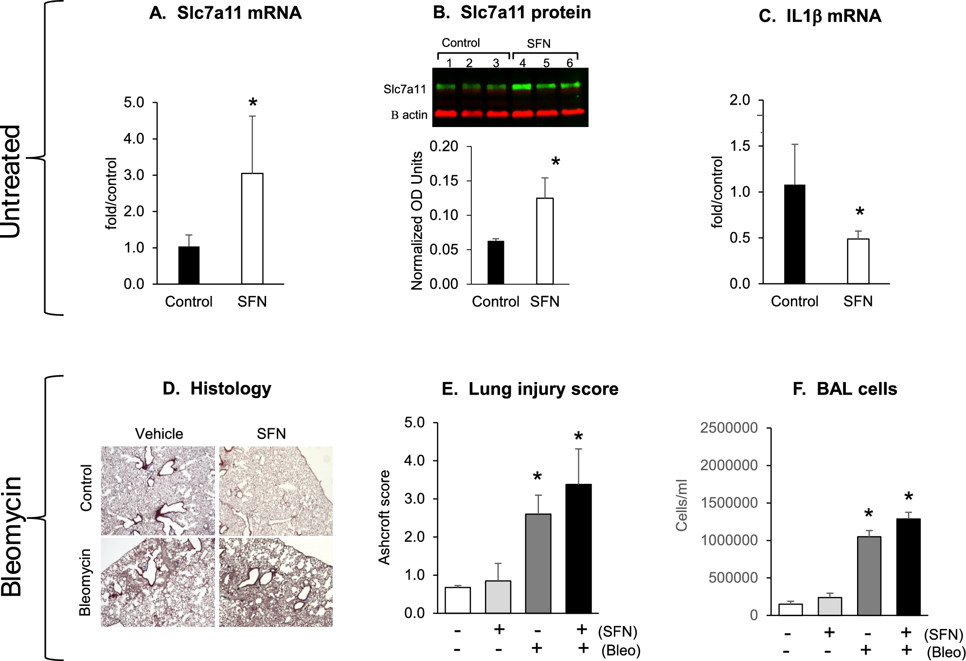Role of Slc7a11 in Bleomycin-Induced Lung Injury