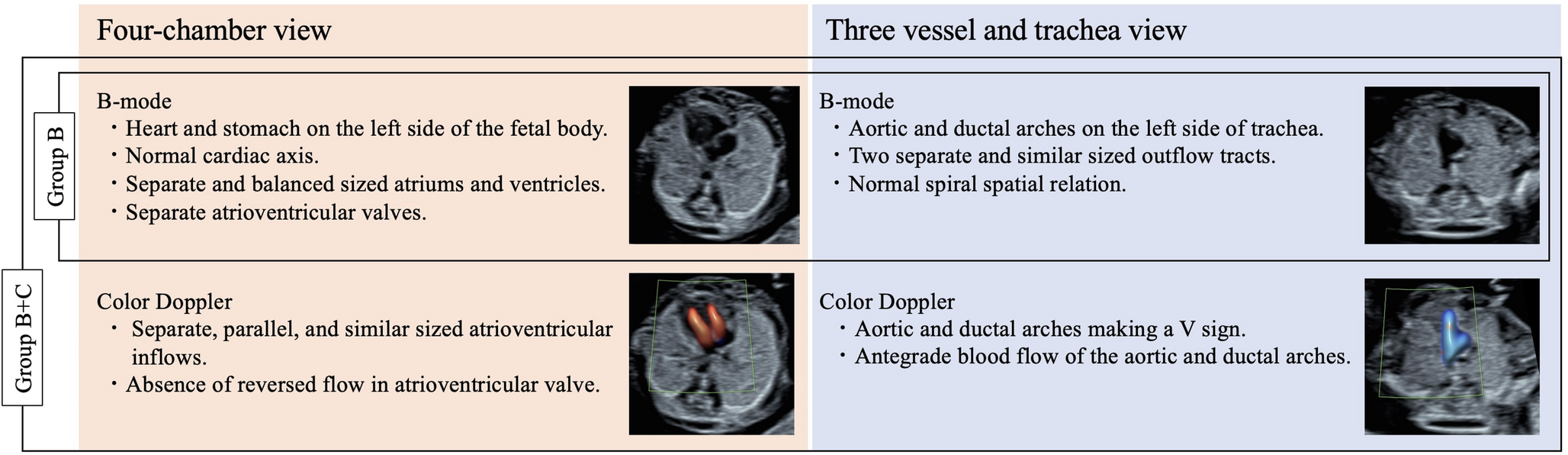 Color doppler in first-trimester congenital heart disease screening: A decade of clinical insights