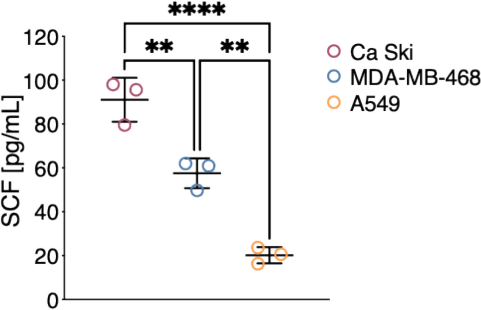 Epigenetic reprogramming of mast and cancer cells modifies tumor-promoting cytokine networks