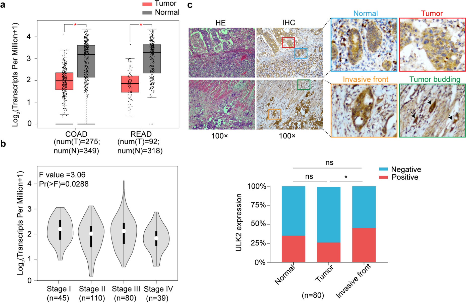ULK2 promotes migration and invasion of colorectal cancer cells via MCT4-mediated lactate export