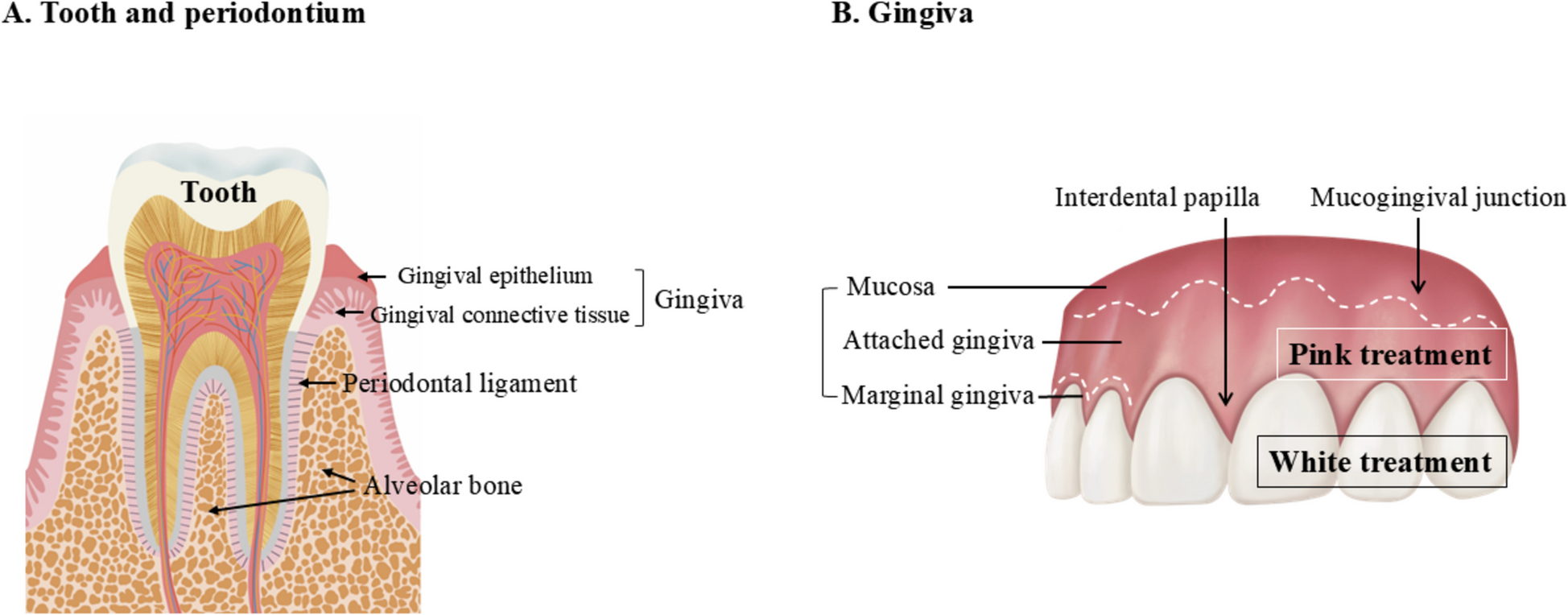 Pink esthetic treatment of gingival recession, black triangle, and gummy smile: a narrative review