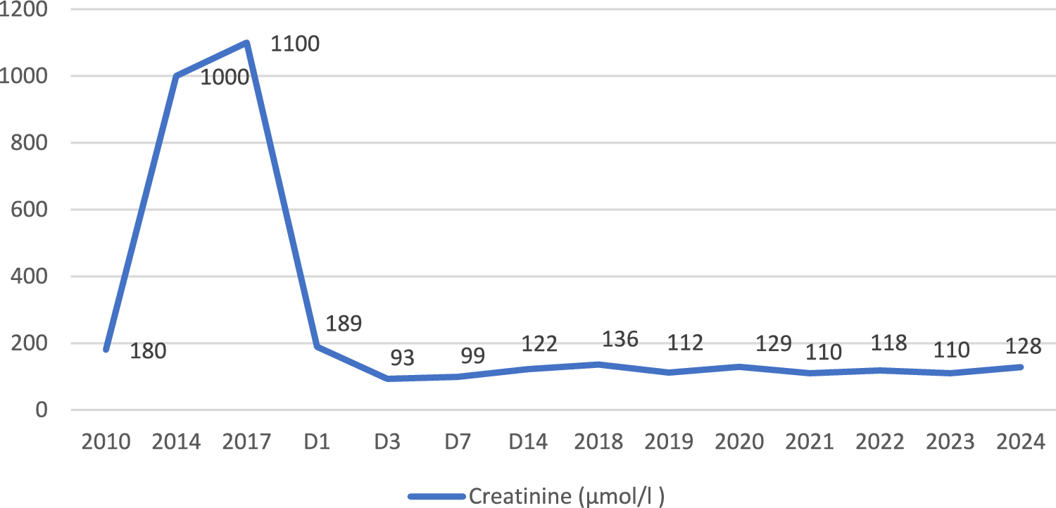 Long-term outcomes of kidney transplantation in a transfusion-dependent alpha-thalassemia patient