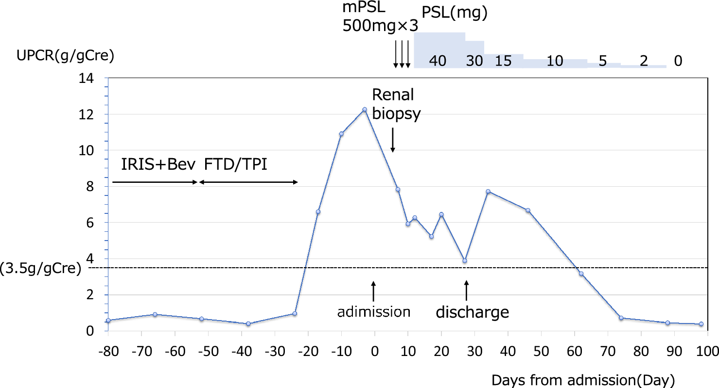 Nephrotic syndrome after switching from irinotecan, S-1, and bevacizumab combination to trifluridine/tipiracil