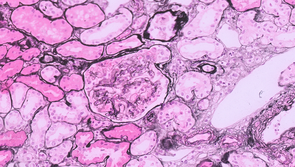 Proteinuria and influence on monoclonal antibody excretion: a pembrolizumab case report and literature review