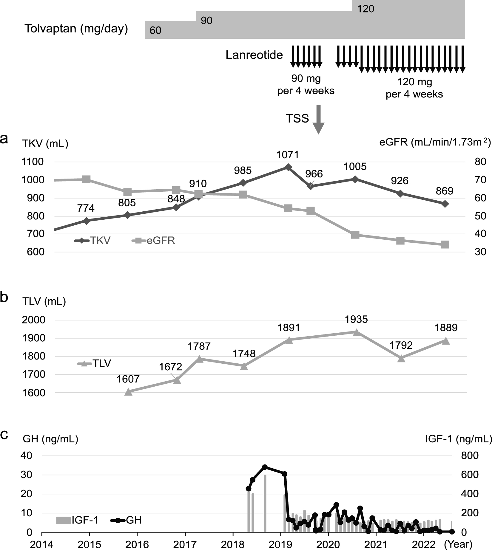 Reduction of polycystic kidney and liver volumes in a patient with tolvaptan-resistant autosomal dominant polycystic kidney disease and acromegaly during lanreotide therapy