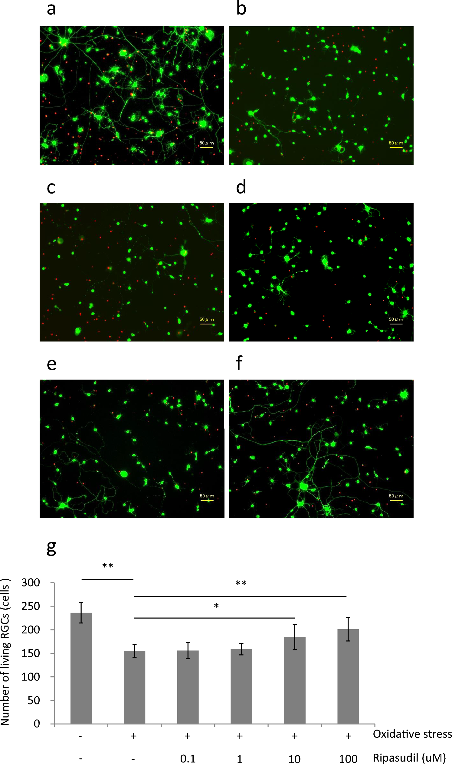 Neuroprotective effect of ripasudil on retinal ganglion cells via an antioxidative mechanism