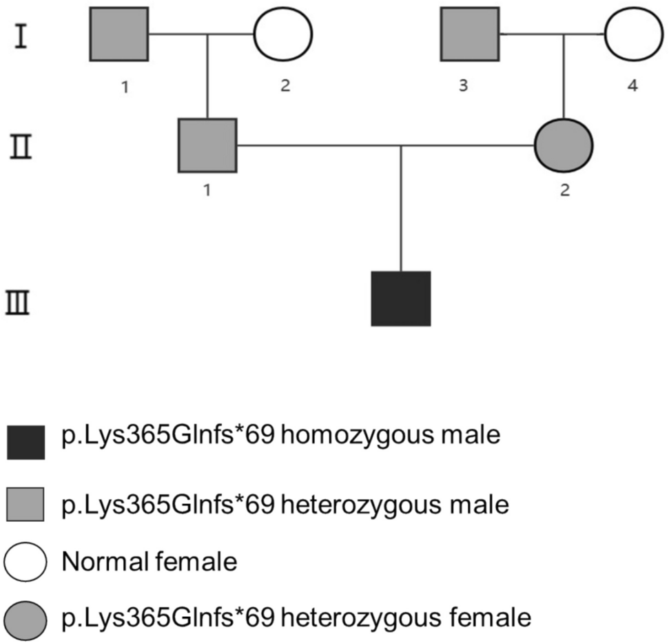 A novel homozygous frameshift mutation (p.Lys365Glnfs*69) in a family with hereditary factor XII deficiency: a case report