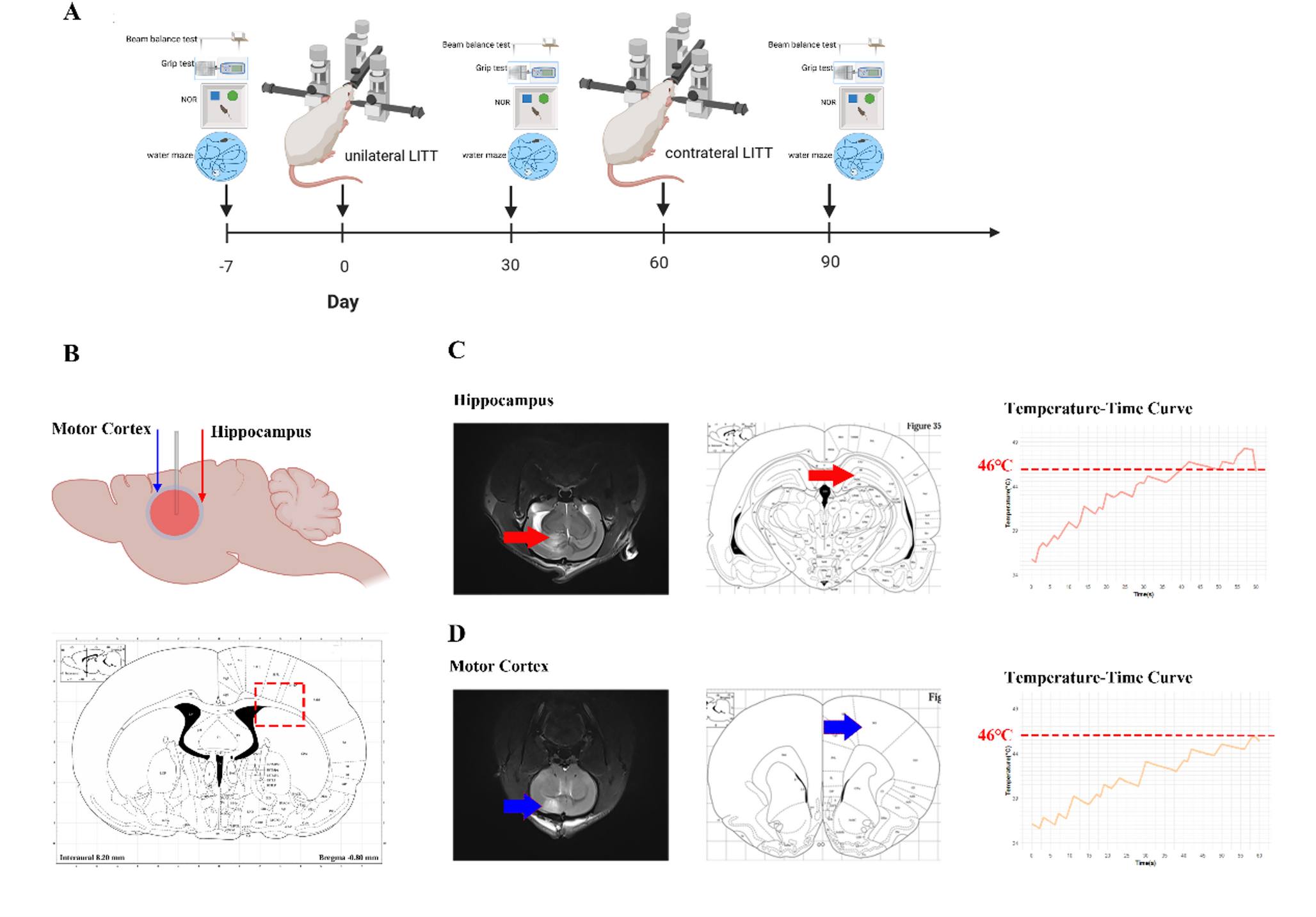 Sublethal laser interstitial thermal therapy leads to confined neurological deficits and glioblastoma regression