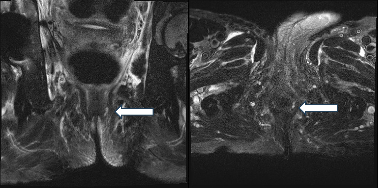 Anorectal Anatomy Quiz: Practical Review