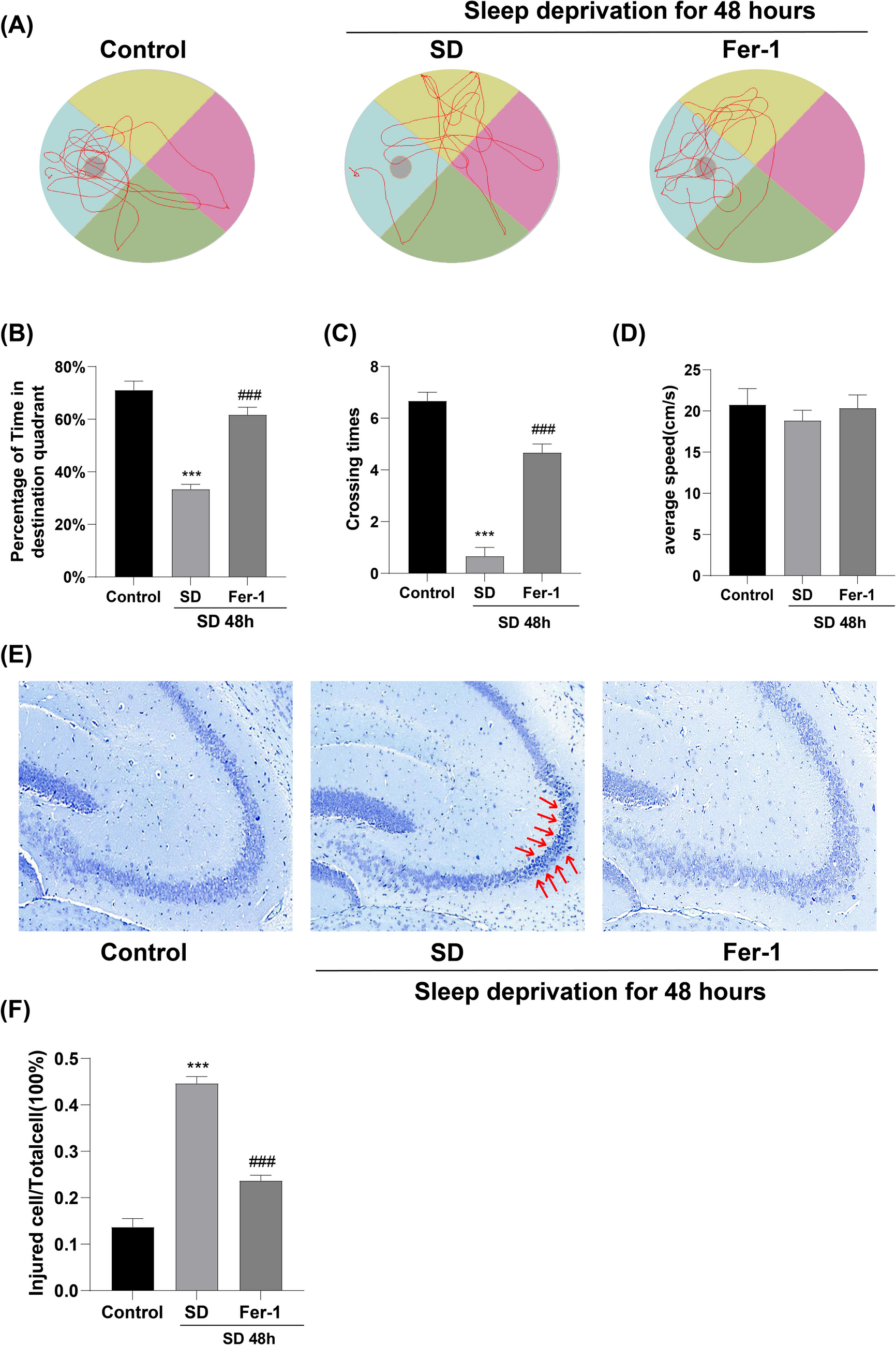 Sleep Deprivation Induces Ferroptosis and Reduces the Expression of GABAB Receptor in Mice