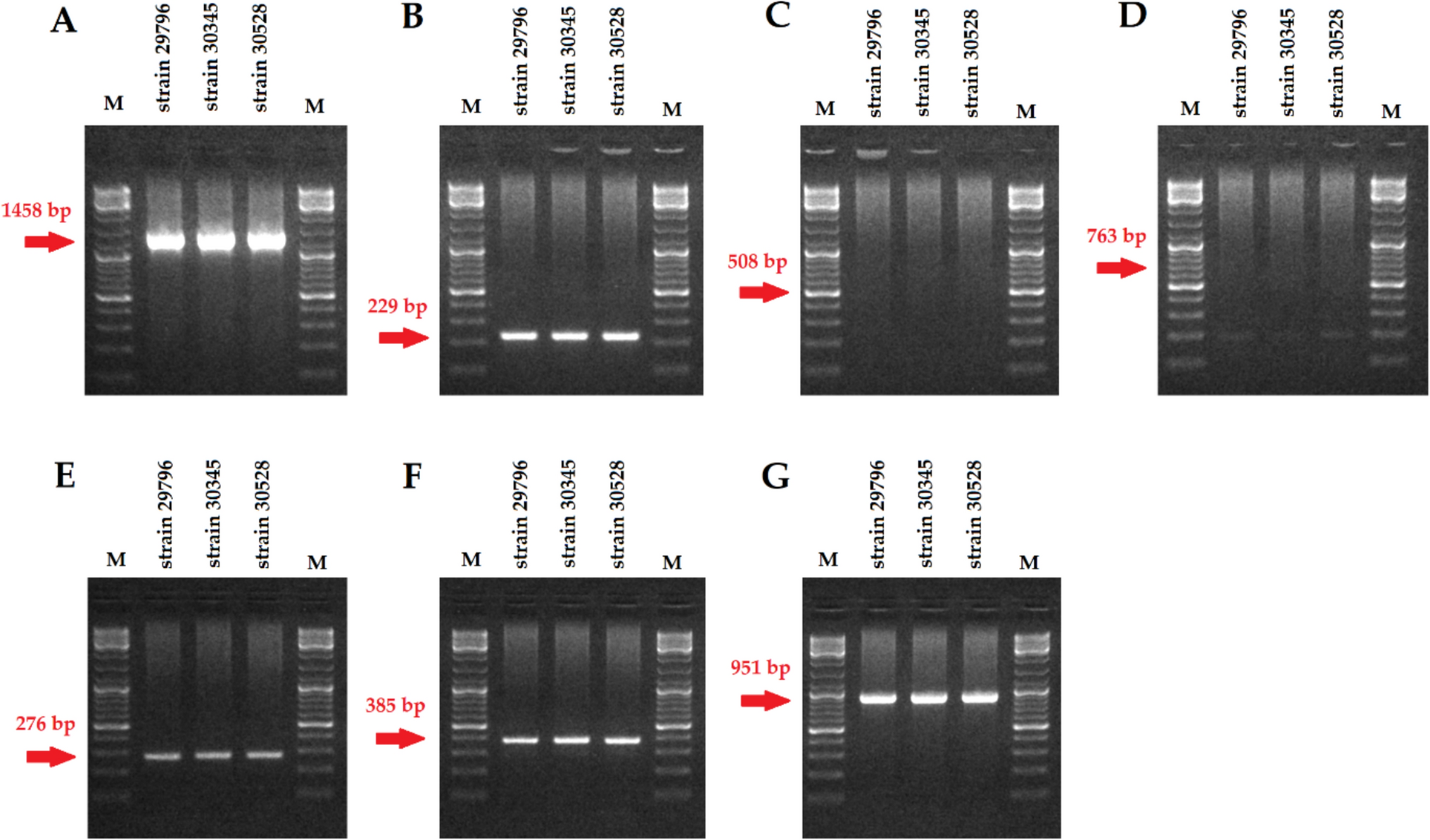 Fighting biofilm: bacteriophages eliminate biofilm formed by multidrug-resistant  on urological catheters