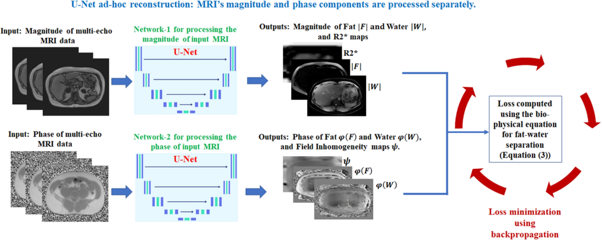 Fat–water MRI separation using deep complex convolution network