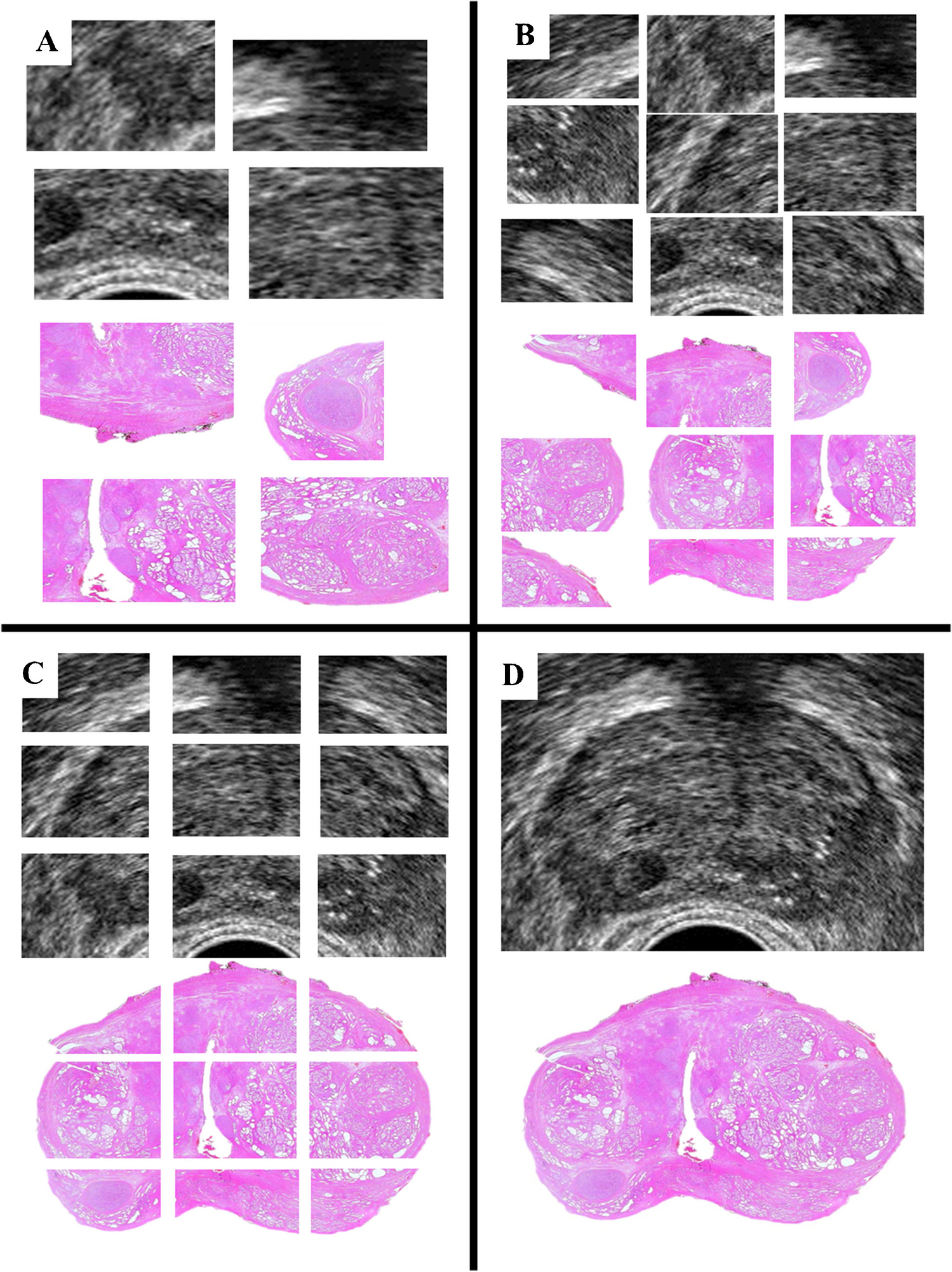 Embedding radical prostatectomy specimens: selective with regular cassettes or complete with large cassettes