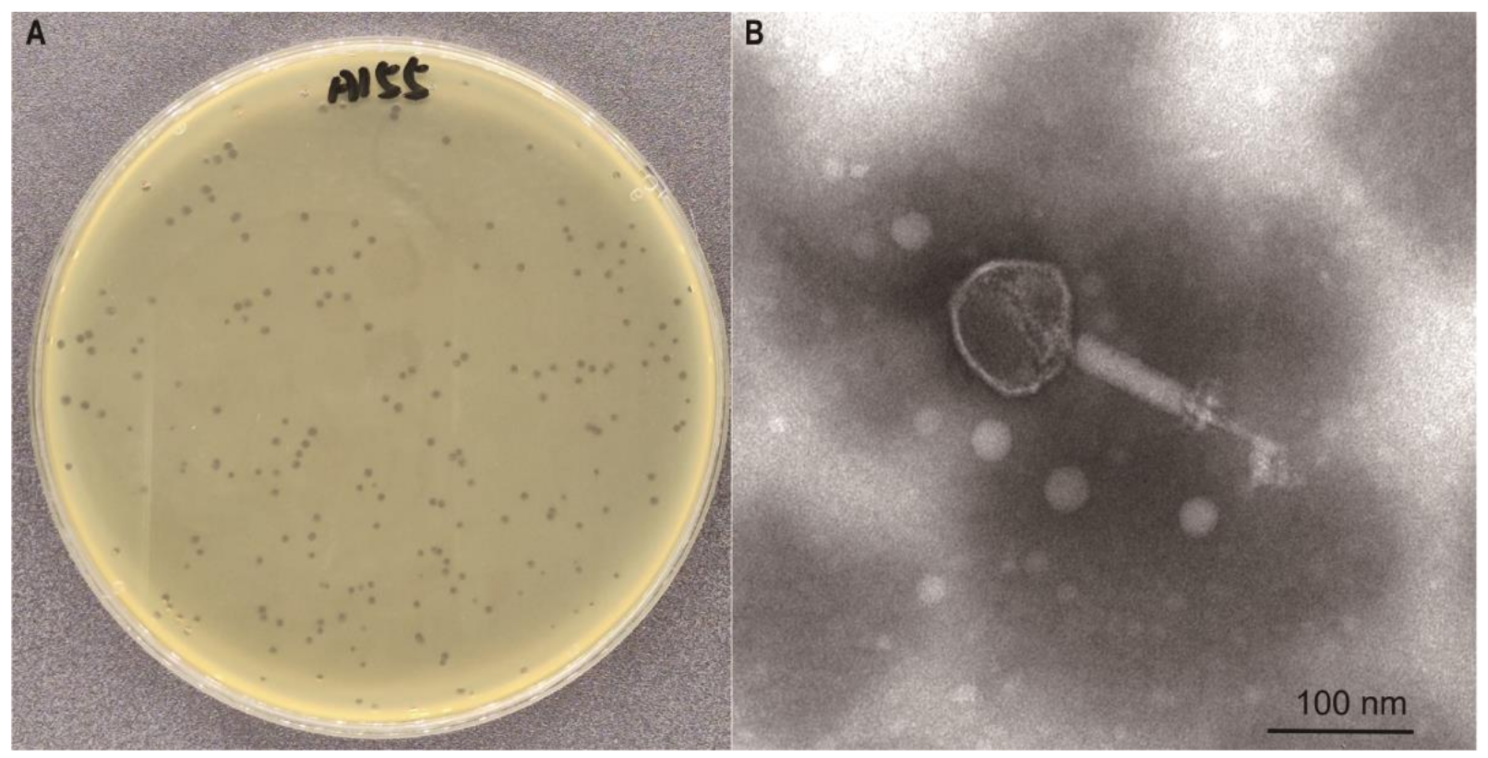 Functional and genomic analysis of Enterococcus phage A155: a potential agent for reducing VRE gut colonization
