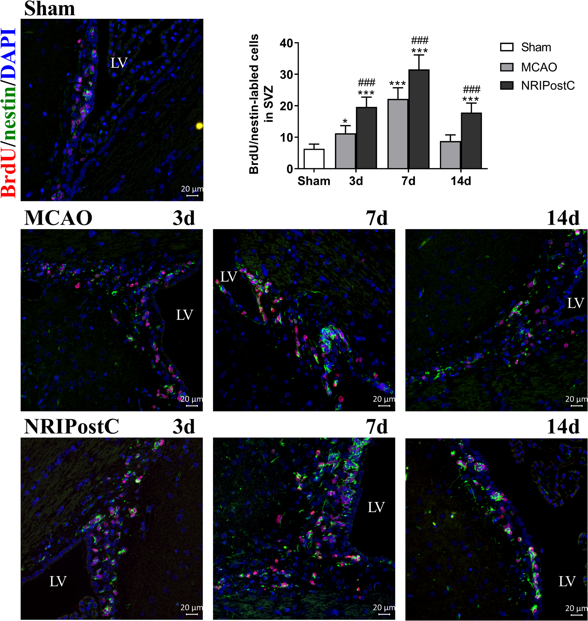 Correction to: Non-invasive remote ischemic postconditioning stimulates neurogenesis during the recovery phase after cerebral ischemia