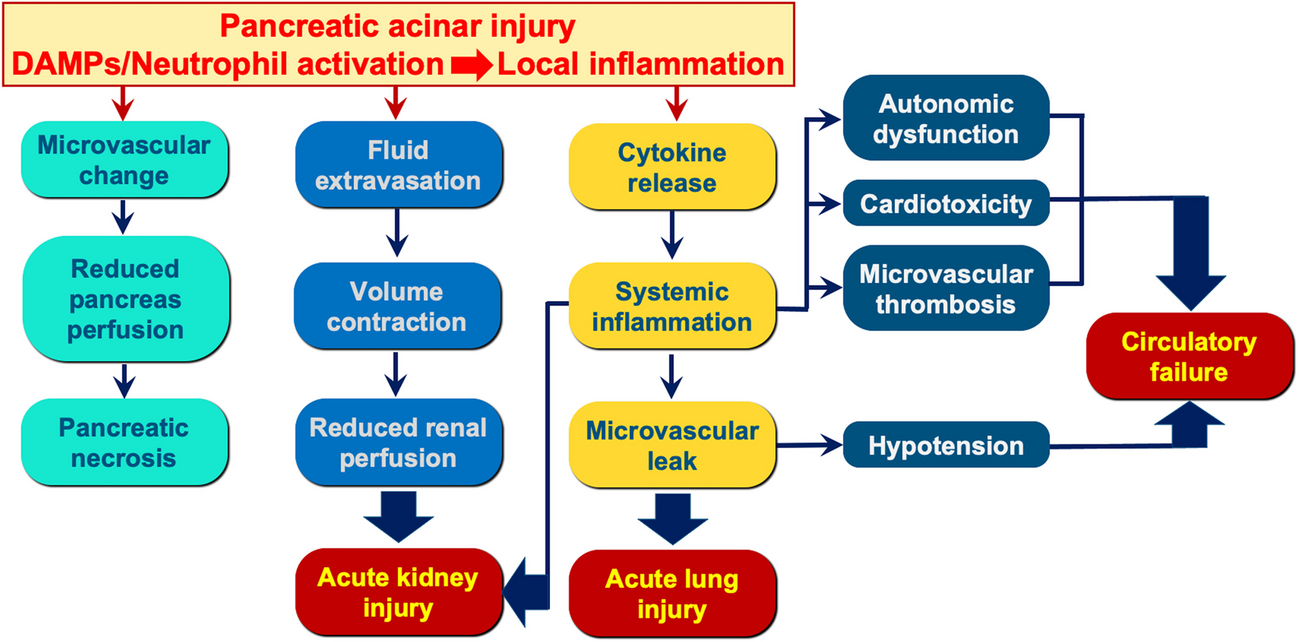 Acute pancreatitis: Translating early mechanisms to bedside management
